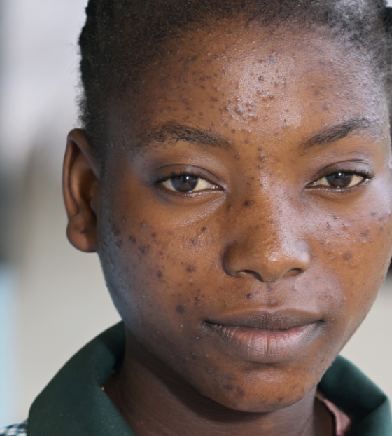 Ein Weg aus der Armut in Sambia